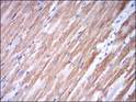 Immunohistochemistry analysis of paraffin-embedded cardiac muscle tissues with DAB staining using Troponin I-FS monoclonal antibody. Immunohistochemistry analysis of paraffin-embedded cardiac muscle tissues with DAB staining using Troponin I-FS monoclonal antibody.