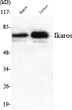 Western blot analysis using Ikaros Monoclonal Antibody against Ramos, Jurkat cell lysate. STJ98508