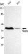 Western Blot analysis using PRMT6 Monoclonal Antibody against HeLa and 293T cell lysates. STJ98542