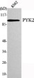 Western blot analysis using PYK2 monoclonal antibody against K562 cell lysate.