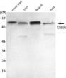 Western Blot analysis using UHRF1 Monoclonal Antibody against mouse heart, 293T, HeLa cell lysate, HeLa nuclear extract.