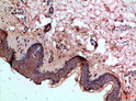 Immunohistochemical analysis of paraffin-embedded Human-skin, antibody was diluted at 1:100