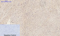 Immunohistochemical analysis of paraffin-embedded Human-uterus tissue. 1, Caspase-1 Polyclonal Antibody was diluted at 1:200 (4°C, overnight). 2, Sodium citrate pH 6.0 was used for antibody retrieval (>98°C, 20min). 3, Secondary antibody was diluted at 1:200 (room tempeRature, 30min). Negative control was used by secondary antibody only.