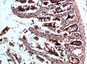 Immunohistochemical analysis of paraffin-embedded human-colon, antibody was diluted at 1:200