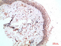 Immunohistochemical analysis of paraffin-embedded human-skin, antibody was diluted at 1:200