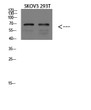 Western blot analysis ofmouse brainlysate, antibody was diluted at 1000. Secondary antibody was diluted at 1:20000