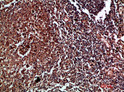 Immunohistochemical analysis of paraffin-embedded human-tonsil, antibody was diluted at 1:200