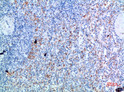 Immunohistochemical analysis of paraffin-embedded human-spleen, antibody was diluted at 1:200