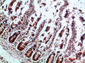 Immunohistochemical analysis of paraffin-embedded human-colon, antibody was diluted at 1:200