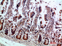 Immunohistochemical analysis of paraffin-embedded human-colon, antibody was diluted at 1:200