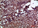Immunohistochemical analysis of paraffin-embedded human-pancreas, antibody was diluted at 1:200