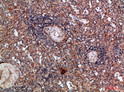 Immunohistochemical analysis of paraffin-embedded human-spleen, antibody was diluted at 1:200