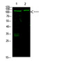 Western Blot analysis of mouse heart and mouse brain cells using primary antibody diluted at 1:1000 (4℃ overnight). STJ98847