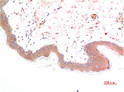 Immunohistochemical analysis of paraffin-embedded human skin tissue using Phospho-Smad3(S425) Mouse mAb diluted at 1:200 STJ98875