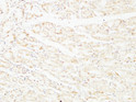 Immunohistochemical analysis of paraffin-embedded Human stomach. 1, Antibody was diluted at 1:200 (4°C overnight). 2, High-pressure and temperature EDTA, pH8.0 was used for antigen retrieval. 3, Secondary antibody was diluted at 1:200 (room temperature, 30min).