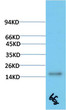 Western blot analysis of Human Serum using TTR Mouse mAb diluted at 1:2000 Western blot analysis of Human Serum using TTR Mouse mAb diluted at 1:2000