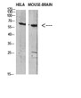 Western blot analysis of HELAmouse brainCell Lysate using antibody. Secondary antibody was diluted at 1:20000