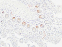 Immunohistochemical analysis of paraffin-embedded Human colon. 1, Antibody was diluted at 1:100 (4°C overnight). 2, High-pressure and temperature EDTA, pH8.0 was used for antigen retrieval. 3, Secondary antibody was diluted at 1:200 (room temperature, 30min).