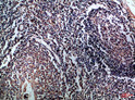Immunohistochemical analysis of paraffin-embedded Human-tonsil, antibody was diluted at 1:100