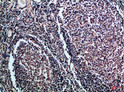 Immunohistochemical analysis of paraffin-embedded Human-tonsil, antibody was diluted at 1:100