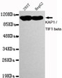 Western blot detection of KAP1/TIF1β in 293T and HepG2 cell lysates using KAP1/TIF1β mouse mAb (1:1000 diluted). STJ99057