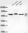 Western blot detection of TBLR1 in mouse brain, mouse heart and K562 cell lysates using TBLR1 mouse mAb (1:1000 STJ99072