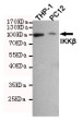 Western blot detection of IKK Beta in THP-1 and PC12 cell lysates using IKK Beta mouse mAb (1:500 diluted).Predicted band size:87KDa.Observed band size:87KDa.