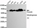 Western blot detection of Pyruvate Dehydrogenase E2 in Jurkat, A549, U251, F9, LNCaP and HeLa cell lysates using STJ99150