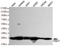 Western blot detection of Hsp27 in Hela, HsHela, A431, COS7, Lncap and MCF7 cell lysates and using Hsp27 mouse mAb (1:1000 diluted).Predicted band size: 23KDa.Observed band size:27KDa.