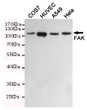 Western blot detection of FAK in COS7, HUVEC, A549 and Hela cell lysates using FAK mouse mAb (1:1000 diluted).Predicted band size: 125KDa.Observed band size:125KDa.