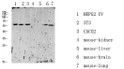Western blot analysis of various lysates; antibody was diluted at 1:1000. Secondary antibody was STJ99600