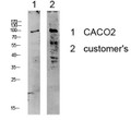 Western blot analysis of various lysates. Antibody was diluted at 1:1000. Secondary antibody was STJ99614