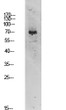 Western blot analysis of 3T3 lysate, antibody was diluted at 1:1000. Secondary antibody was diluted STJ99630