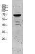 Western blot analysis of SW480 lysate, antibody was diluted at 1:1000. Secondary antibody was STJ99636