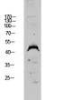 Western blot analysis of A549 lysate, antibody was diluted at 1000. Secondary antibody was diluted at 1:20000