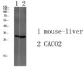Western blot analysis of various lysate, antibody was diluted at 1000. Secondary antibody was diluted at 1:20000
