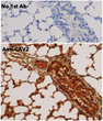 Immunohistochemistry of mouse lung using anti-CAV2 antibody and FFPE tissue after heat-induced antigen retrieval. Anti-CAV2 antibody at 1:500/DAB detection.