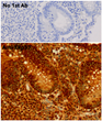 Anti PDIA3 Goat Polyclonal antibody immunohistochemistry human STJ140035