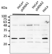 Anti RAB7A Goat Polyclonal antibody western blot hela STJ140063