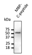Anti-C-peptide antibody at 1:1000 dilution; 20 ng of recombinant protein per lane; rabbit polyclonal to goat IgG (HRP) at 1:10000 dilution