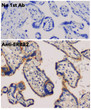 Anti ERBB2 Goat Polyclonal antibody immunohistochemistry human STJ140115