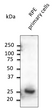 Anti-Rab31 antibody at 1:1000 dilution using RPE primary cell culture; rabbit polyclonal to goat IgG (HRP) at 1:10000 dilution