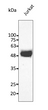 Anti-CD2 antibody at 1:2500 dilution; lysates at 50 µg per lane; rabbit polyclonal to goat IgG (HRP) at 1:10000 dilution