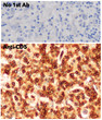 Immunohistochemistry of human lymph node using anti-CD5 antibody and FFPE tissue after heat-induced antigen retrieval. Anti-CD5 antibody at 1:750/DAB detection.