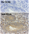 Anti OCLN Goat Polyclonal antibody immunohistochemistry human STJ140166