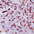 Human pancreatic ducts stained with anti-keratin 19 antibody using peroxidase-conjugate and DAB chromogen. Note the cytoplasmic staining of ductal cells.