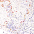 Anti-Podoplanin antibody IHC Human lymph node STJ180283