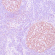 Anti-OCT-2 antibody IHC Human lymph node STJ180327