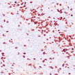 Anti-Lambda antibody IHC Human tonsil STJ180359