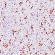 Anti-SOX-9 antibody IHC Human panceas STJ180371